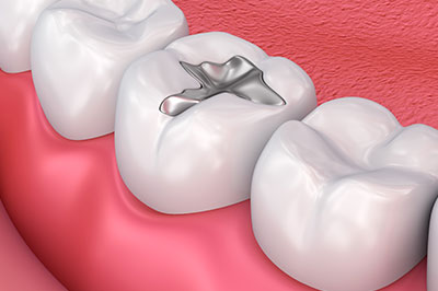 Cuddy Family Dentistry | Cosmetic Dentistry, Oral Exams and Laser Dentistry