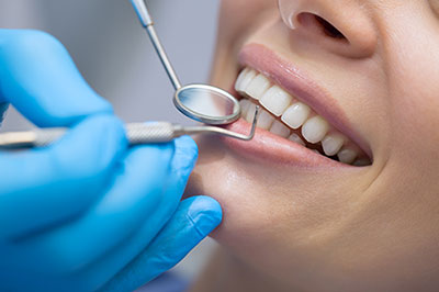 Cuddy Family Dentistry | Ceramic Crowns, Dental Sealants and Dental Cleanings