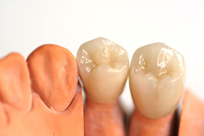Cuddy Family Dentistry | Dental Cleanings, Root Canals and Extractions