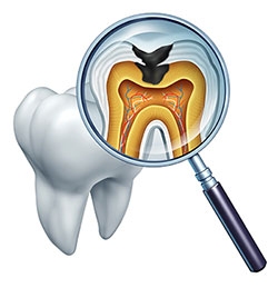 Cuddy Family Dentistry | Digital Impressions, All-on-6 reg  and Emergency Treatment