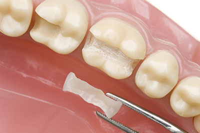 Cuddy Family Dentistry | Oral Cancer Screening, Laser Dentistry and Teeth Whitening