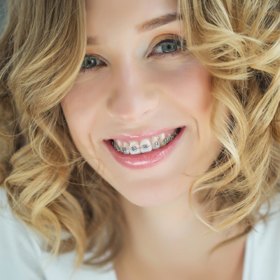 Cuddy Family Dentistry | Night Guards, Fluoride Treatment and Veneers