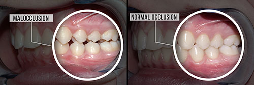 Cuddy Family Dentistry | Digital Impressions, Dental Fillings and Dental Bridges