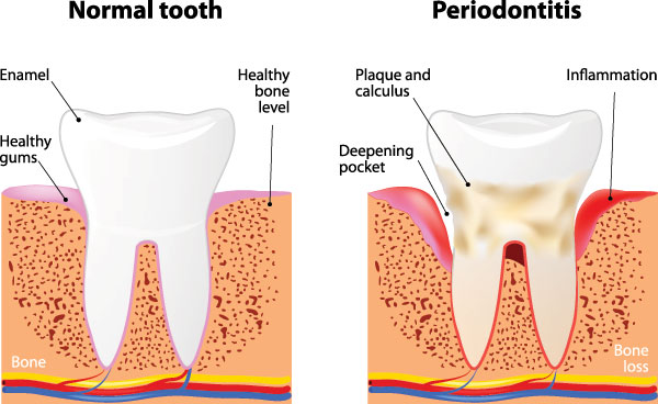 Cuddy Family Dentistry | Teeth Whitening, Periodontal Treatment and Intraoral Camera