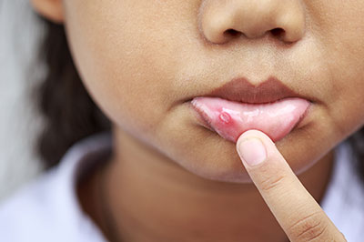 Cuddy Family Dentistry | Laser Dentistry, Full Mouth Reconstruction and Dental Cleanings