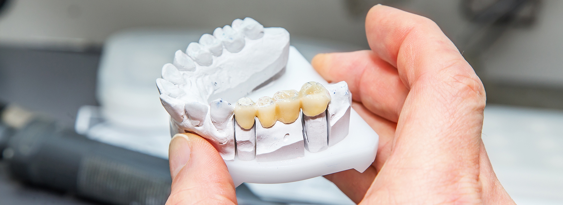 Cuddy Family Dentistry | Dental Cleanings, Teeth Whitening and Digital Impressions