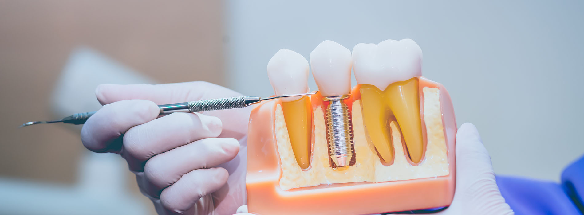 Cuddy Family Dentistry | Periodontal Treatment, Crowns and Cosmetic Dentistry