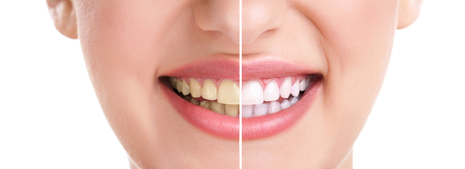 Cuddy Family Dentistry | All-on-6 reg , Pediatric Dentistry and CBCT